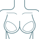 BREAST SURGERIES