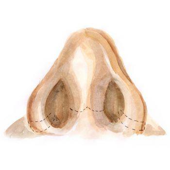 Nose shape correction 2