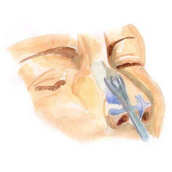Nose shape correction 4